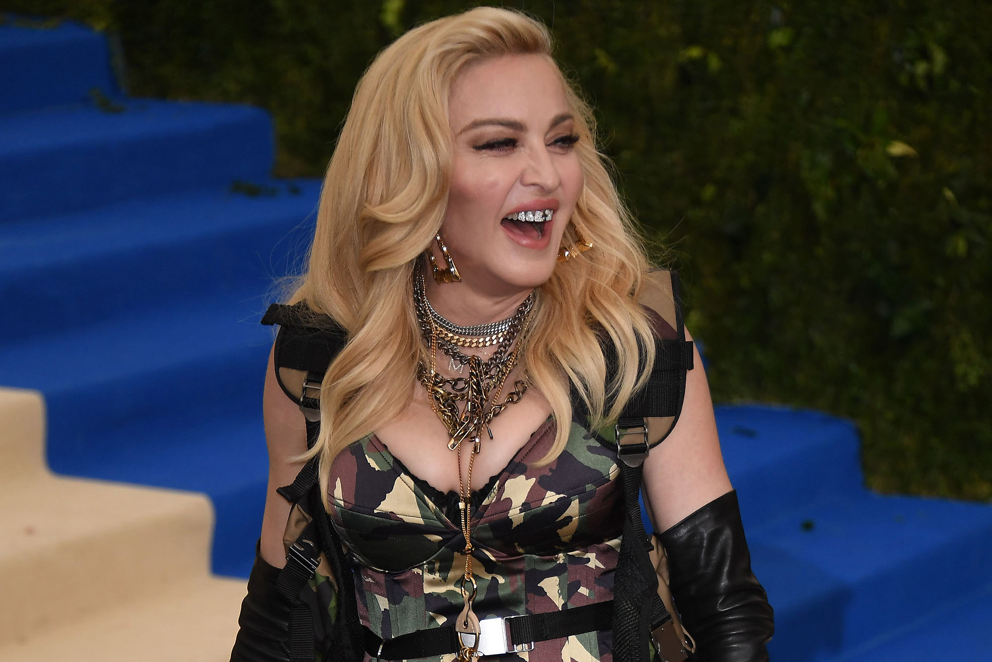 Madonna explains her signature grills I have really ugly teeth